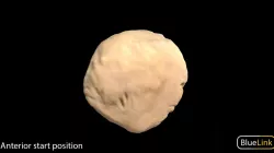 Patella