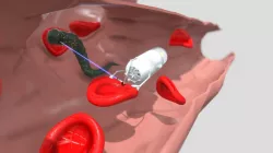microbot