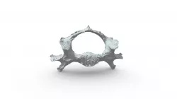 raw C6 vertebra scan
