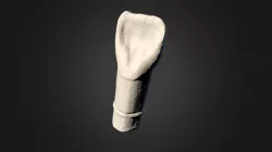 Scansione 3D dente impianto