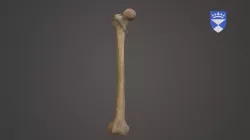 Femur