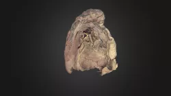 Left Lung