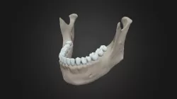 Mandible in 3D