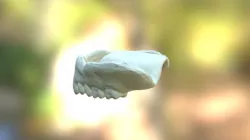 Denture