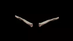 Left and Right Clavicles 18yo male