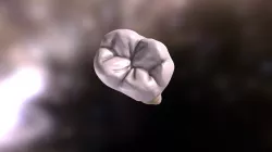 PRIMER MOLAR INFERIOR (46)