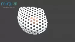 Reconstruccion mamaria