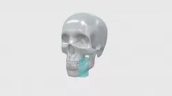 Sectional Mandible L