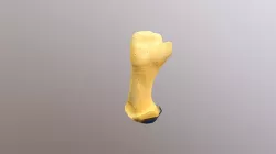 Stump