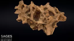 Diseased human vertebra