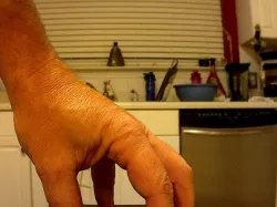 My Scanned Left Hand...looks like zombie hand