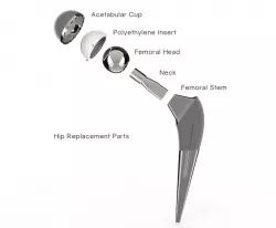Prosthetic Hip Implant
