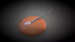 Capsulorhexis - Underrunning (Model 1:View 1/3)