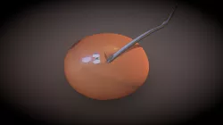 Capsulorhexis - Underrunning (Model 1-View 2/3)