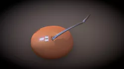 Capsulorhexis - Underrunning (Model 1-View 3/3)