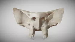 Sphenoid Bone