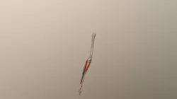 Forearm Flexor Side