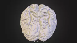 Brain2
