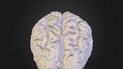 Brain3