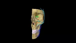 Cranial nerves