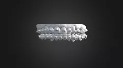Dentes