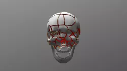 Exploding skull