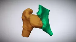 Femur