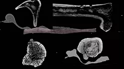Seeing inside the bone