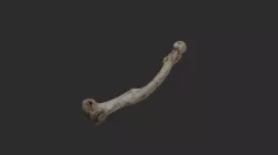 Human Femur (Paget's Disease)