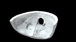 Metopic frontal bone (VCU_3D_5300)