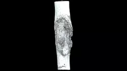 Tibia with Gunshot Wound (VCU_3D_5294)