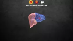 Liver-cut