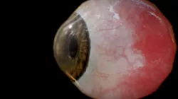 Reallistic eye - Low res preview version