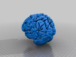 Human brain from MRI