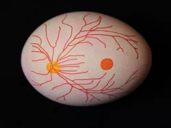 Egg-Bot Ocular Fundus