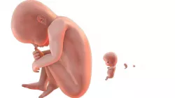 fetus simple 5 set Low-poly  3D model