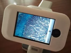 iPhone to Microscope mount