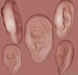 Van Gogh's cut off ear