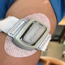 Dexcom G4/G5 cover