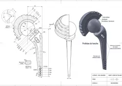 prosthetic hip joint