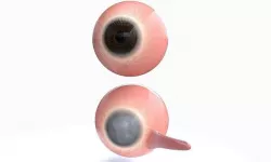 REALISTIC EYE AND BLIND EYE EFFECT 3D model