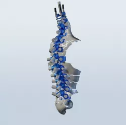 robot spine 3D model