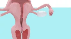 Animated Uterus and Mirena IUD Animable 3D model