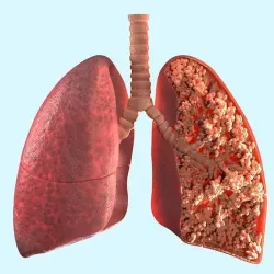 lungs 3D model 3D model