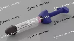 Dental composite - Composite resin 3D model