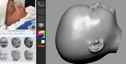 Fetus Head 3D model