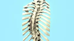 Spine Implant 3D model