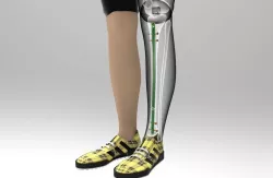 Tibial Intramedullary Nail 3D model