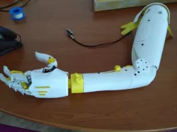 Complete prosthetic arm for hackberry hand
