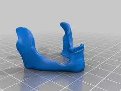 Jaw Mask